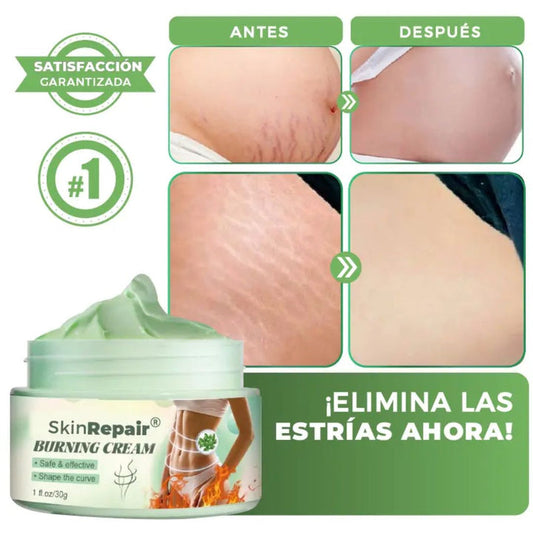 Crema Antiestrias Skinrepair 🌼💧 (Oferta)